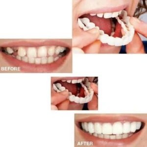 Nap On Smile Sorriso Dei Denti Flessione Dei Denti Dentiera