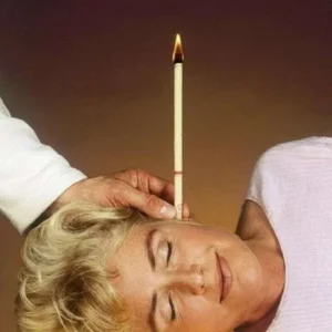 12 Pezzi Coni Candela Di Cerume Rimozione Candele Orecchio