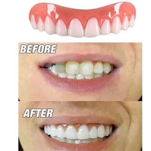 PROTESI DENTALE PERFECT SMILE DENTIERA DENTI