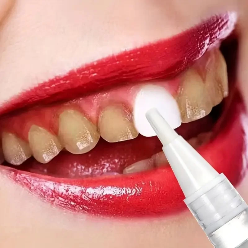 Penna Sbiancante Per Denti Indolore Senza Sensibilità Facile Da Usare