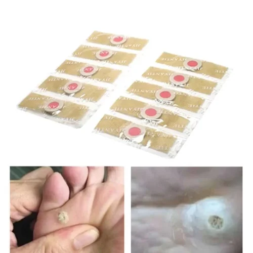 Lotto da 6 Pezzi Medicazione Cerotto Patch Rimozione Calli e Verruche