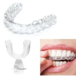 4 Pezzi Silicone Dentale Notte Aiuto Sonno Sbiancamento