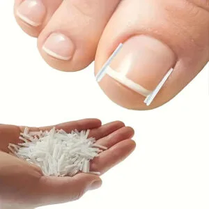 40 pezzi Strisce Correttive Per Unghie Incarnite Strumento Per Pedicure Patch