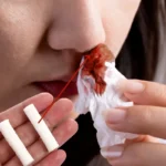 50pz Assorbenti Naso Congestione Allenamento Pugilato Naso Sensibile