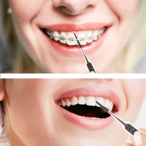 Spazzole dentali carbone Dr. Emma 100 pezzi filo apparecchio preciso carbone