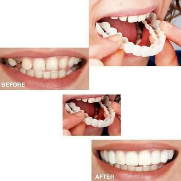 Nap On Smile Sorriso Dei Denti Flessione Dei Denti Dentiera Copertura Dentale